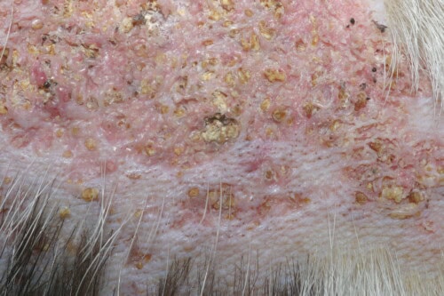 Calcinose cutanée : Vue rapprochée