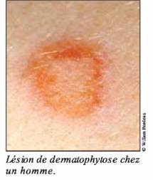 dermatophytoses-canines-felines2