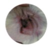 intolerance-allergie-alim9