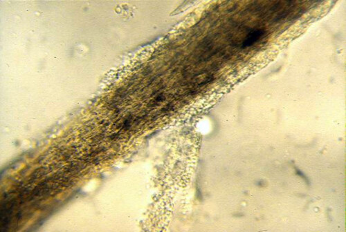 Dermatozoönosen: Diergeneeskundige aanpak en implicaties voor de volksgezondheid