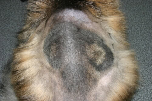 Les pièges du diagnostic des dermatophytoses